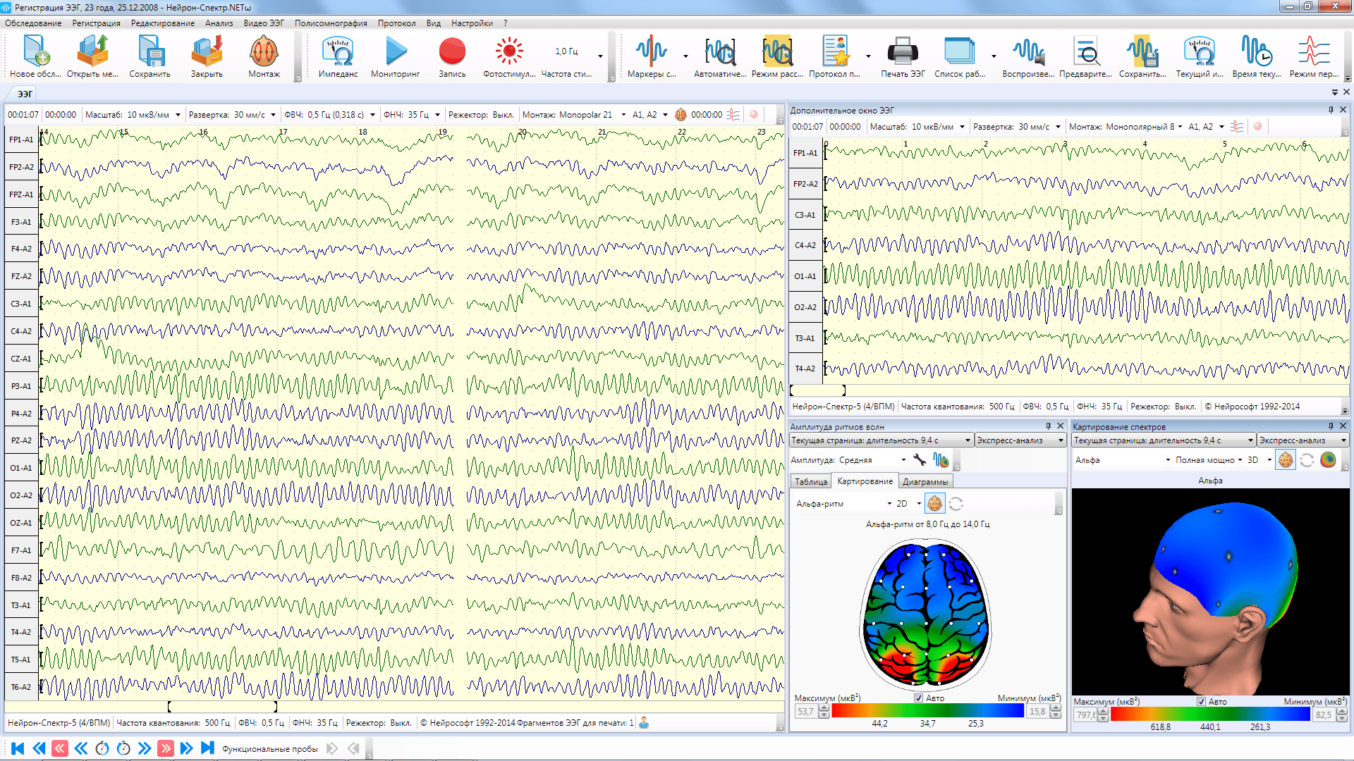 Ээг работа. Прибор Нейрон спектр 2 энцефалограммы. Электроэнцефалограф Нейрон-спектр-2 (16-ти канальный ЭЭГ). Аппарат ЭЭГ Нейрософт. Приборы для электроэнцефалограммы (ЭЭГ).